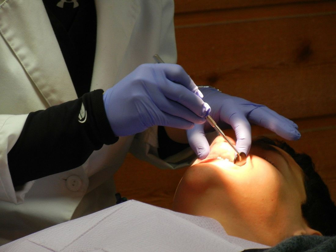 sbiancamento denti prima e dopo