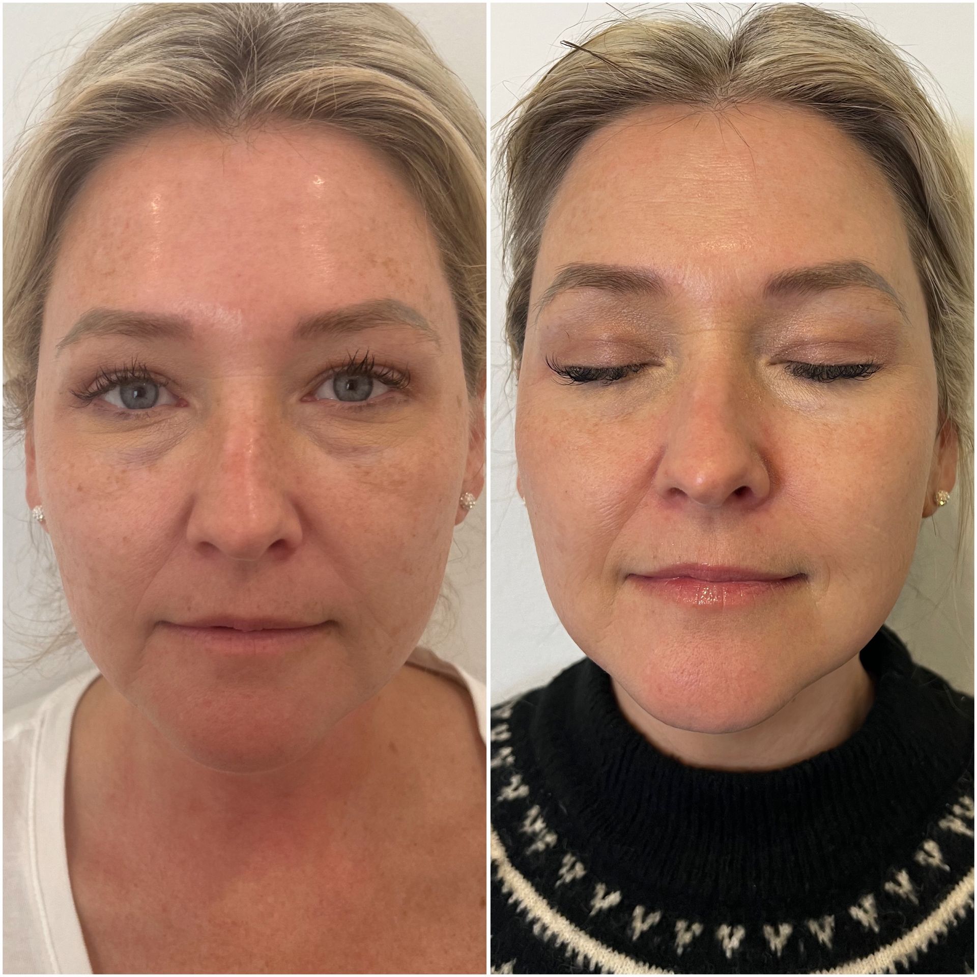 A before and after photo of a woman 's face