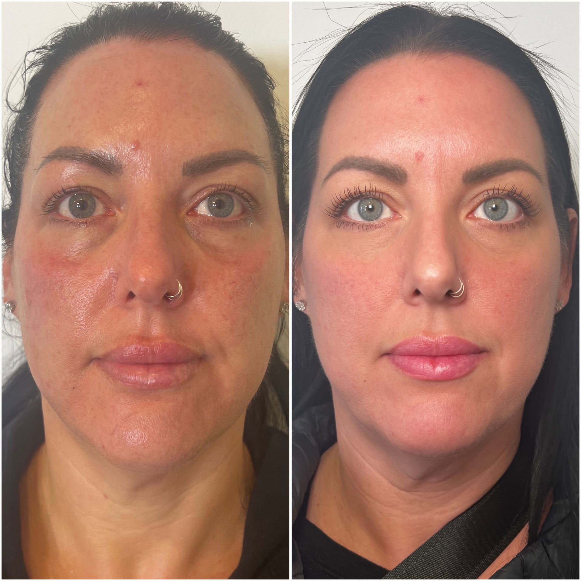 A before and after photo of a woman 's face