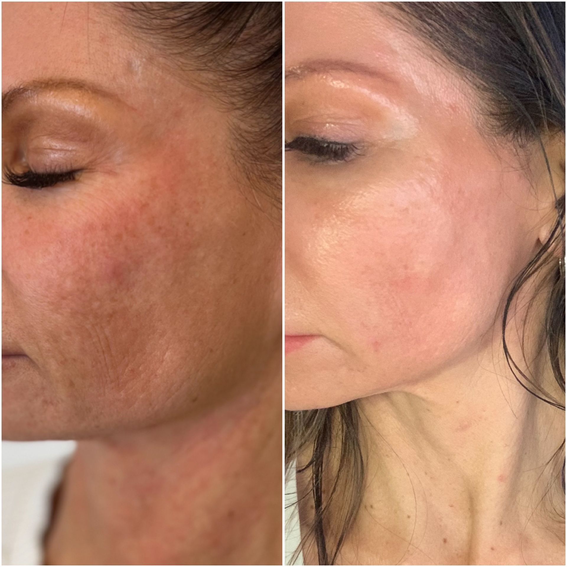 A before and after photo of a woman 's face.