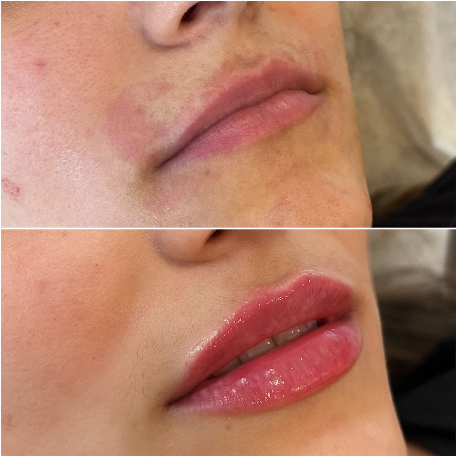 Before and after of lips, showing a change in size and appearance, with glossy finish.
