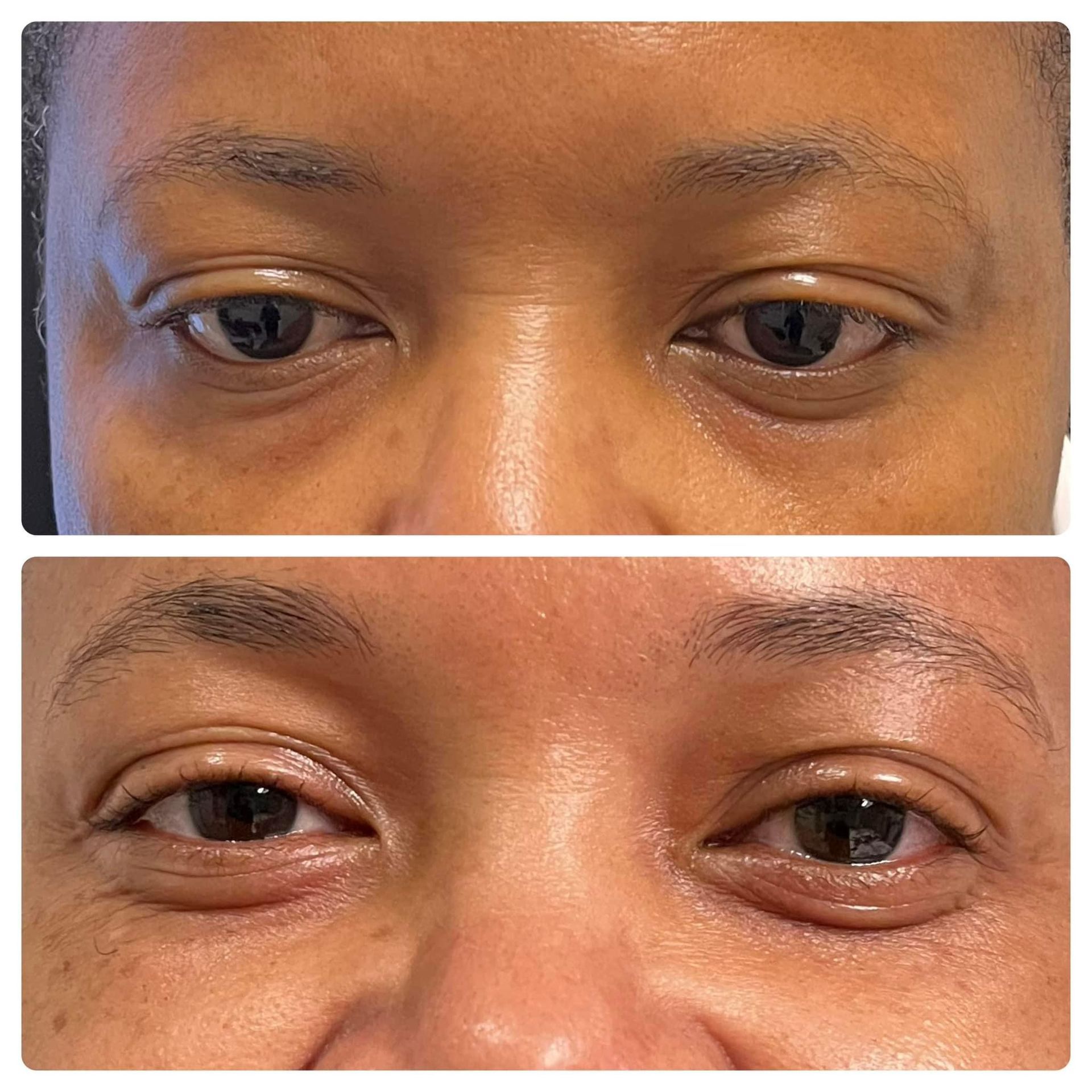A before and after photo of a woman 's eyes