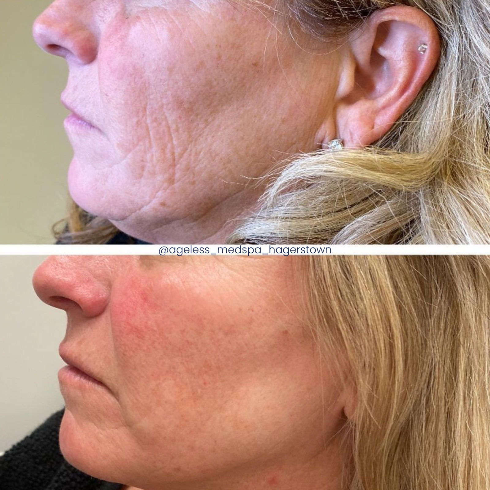 A before and after photo of a woman 's face