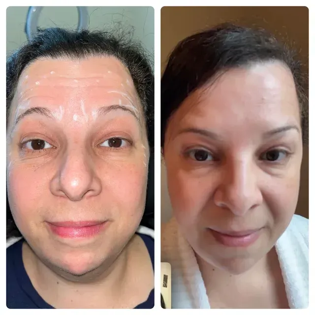 A before and after photo of a woman 's face