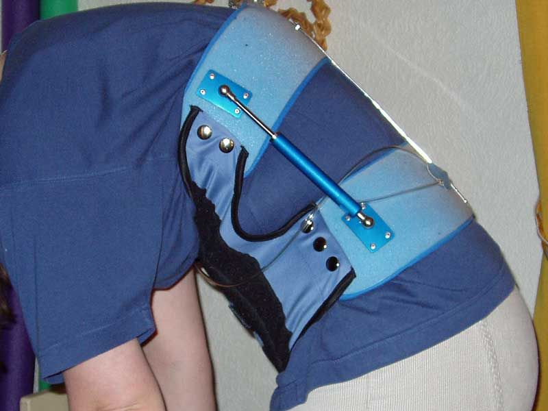 Eine Person, die eine blau-schwarze Orthese auf dem Rücken trägt