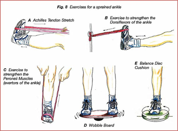 Diagram of rehabilitation exercises for a sprained ankle