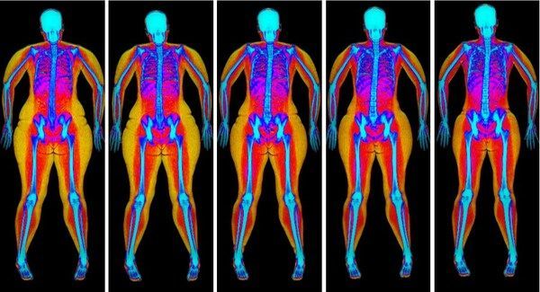 Five full-body thermal scans of a human figure on a black background, showing heat patterns in bright colors.