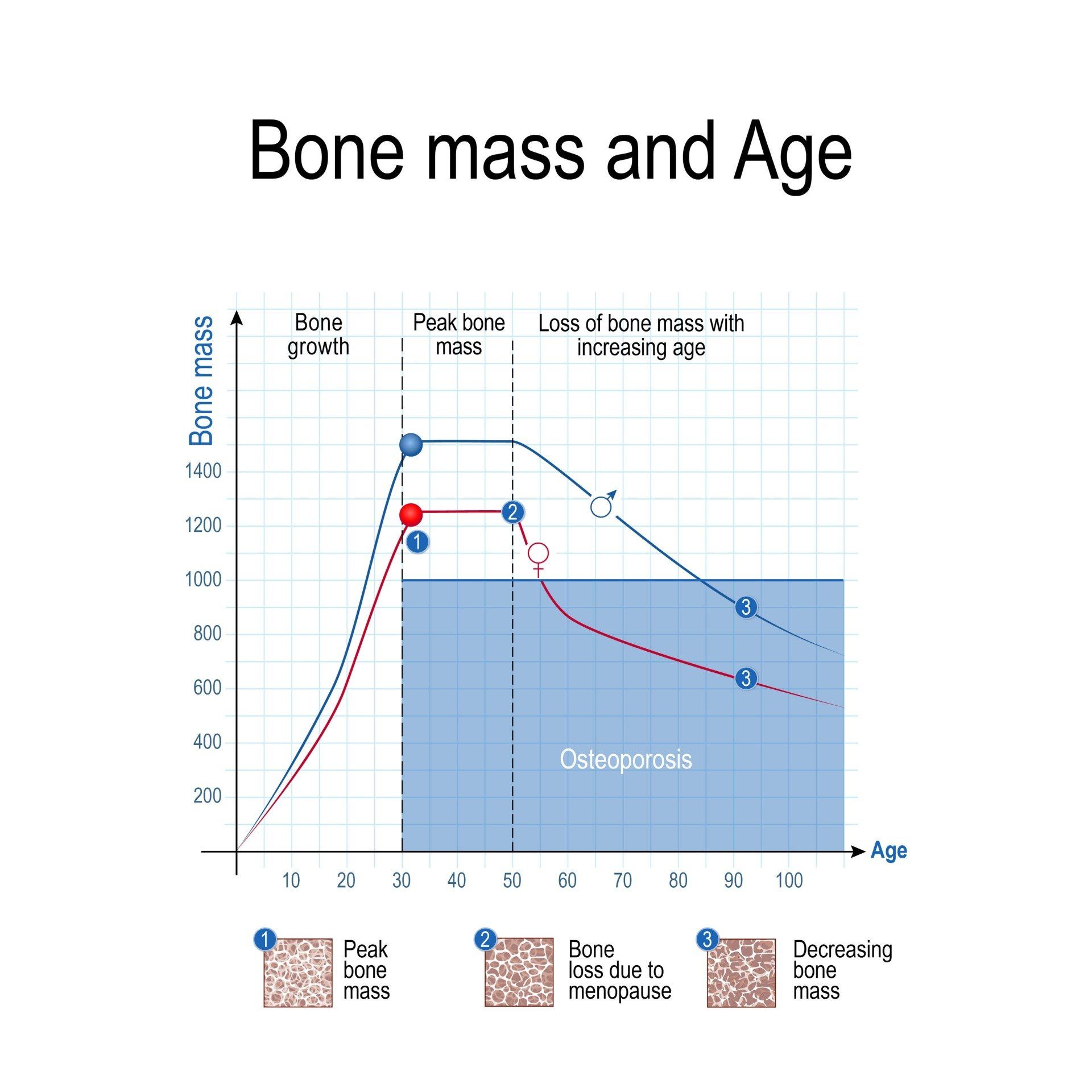 Chart showing bone mass versus age, with peak bone mass in youth and declining bone mass after menopause.