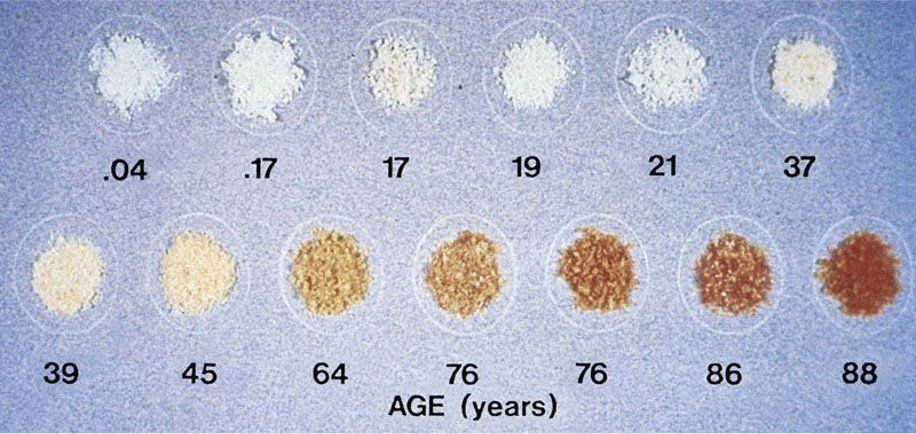 Circular color samples fading from pale blue to brown, labeled with ages 04 to 88 years.