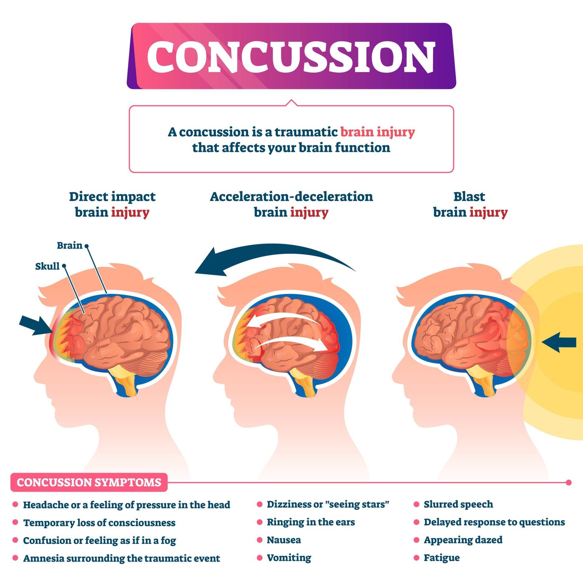 Infographic on concussion: three brain injury types with symptoms, in pink and blue.