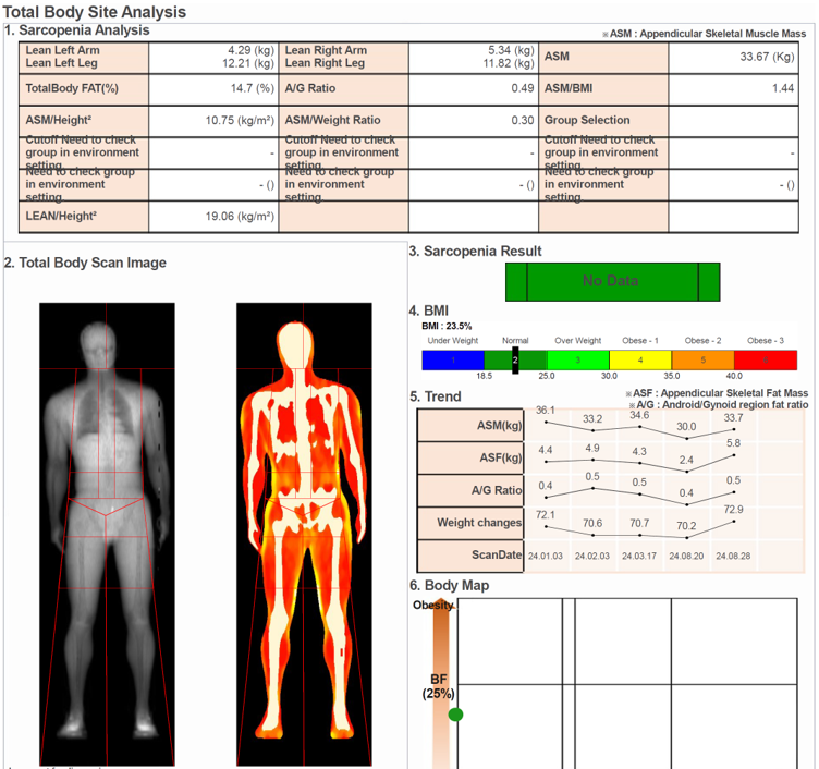 A DEXA picture of a man 's body is shown on a computer screen