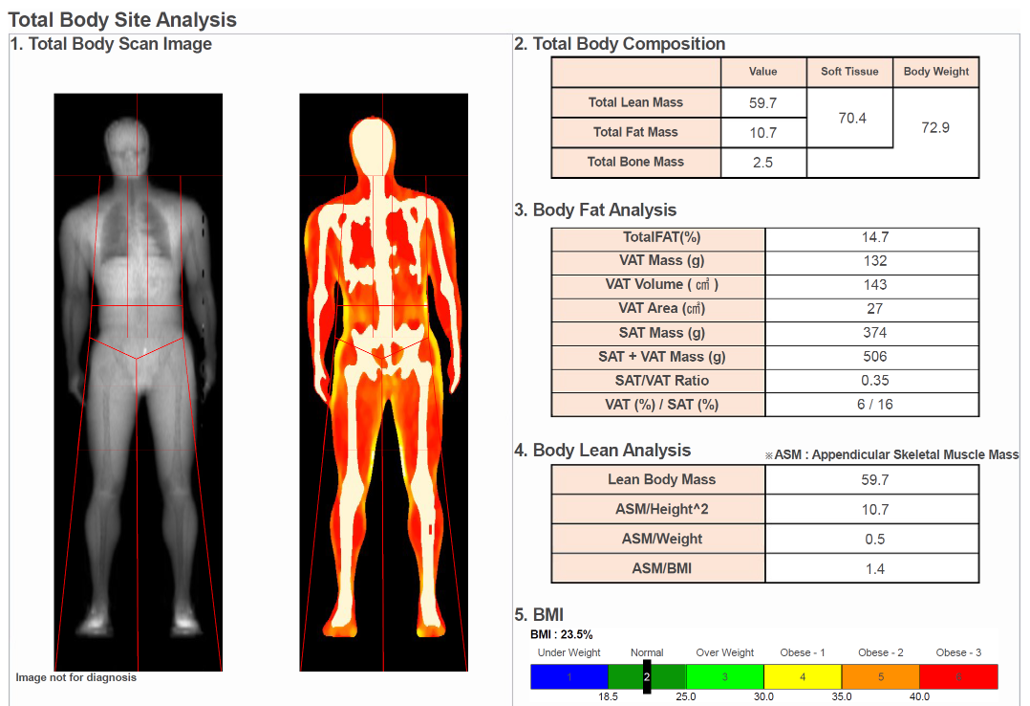 Sample DEXA body composition results