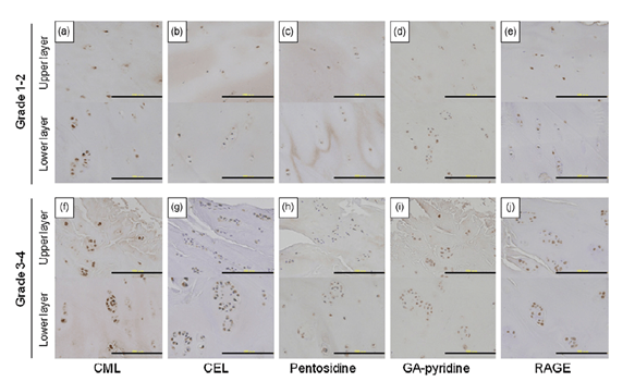 Grid of microscope panels comparing cells under CML, CGL, pentosidine, gly-pyridine, and RAGE conditions