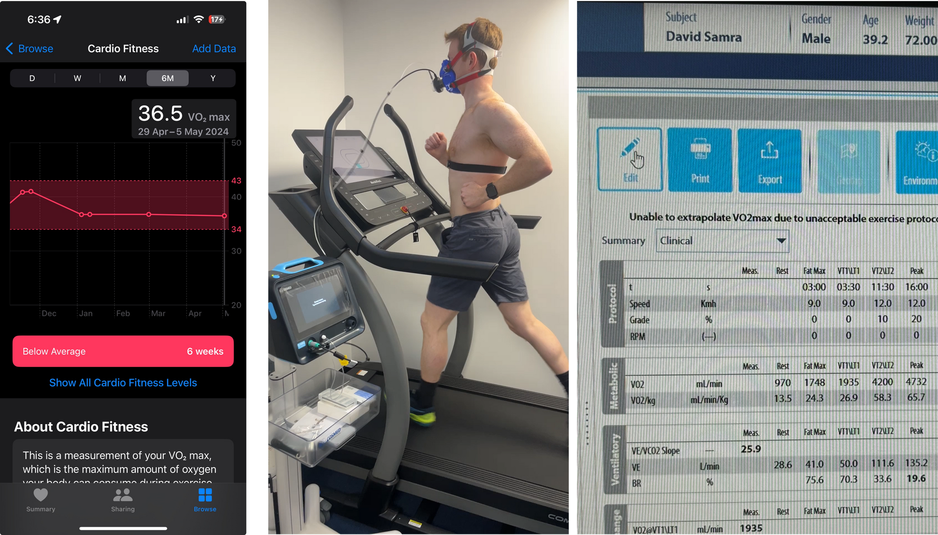 Dr Samra is running on a treadmill doing a VO2 max test with a heart rate monitor on his chest.