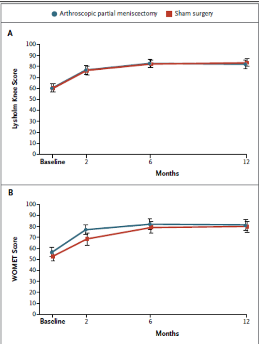 Graph from the trial showing no difference in outcomes between arthroscopic partial meniscectomy and sham surgery