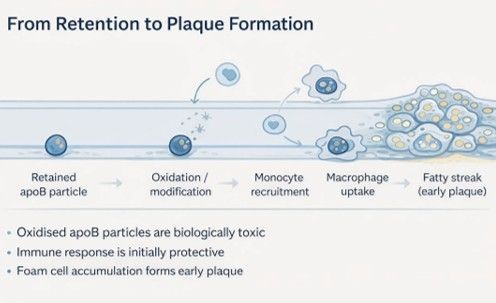 Illustration for the section on progression from particle retention to plaque formation.