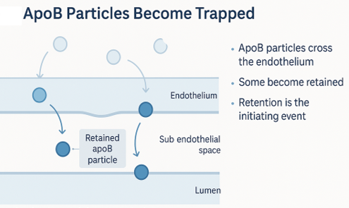 Illustration for the section on retention of apoB containing particles in the artery wall.