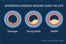 Cumulative cardiovascular risk illustration, panel 4 of 4.