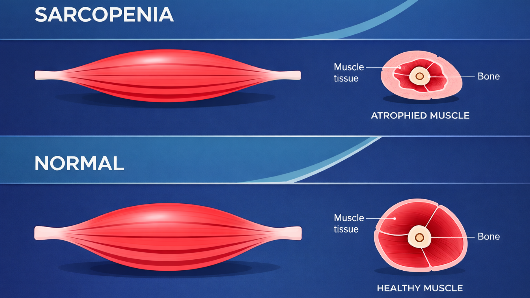 Sarcopenia - Conditions treated here at Progressive Sports