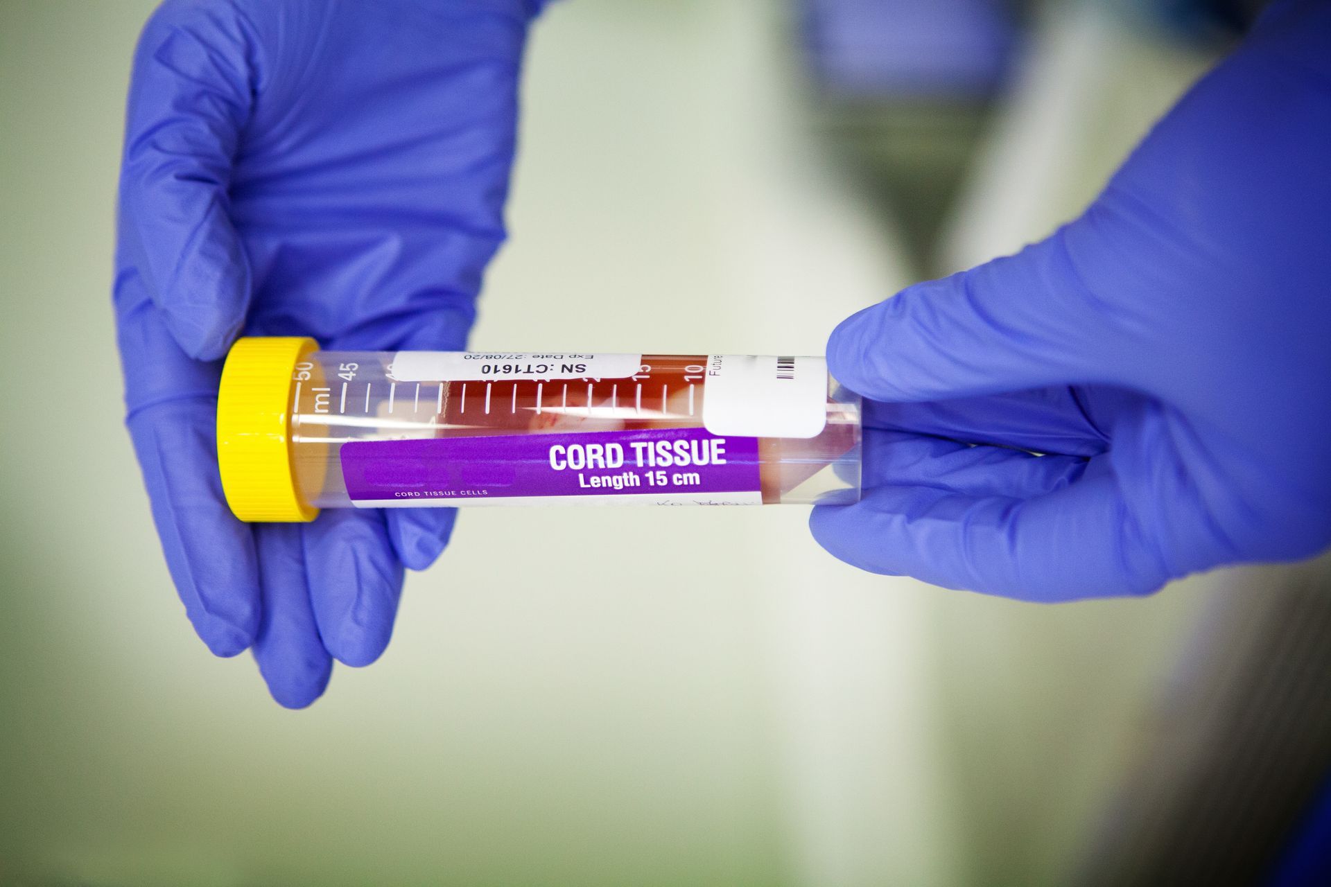 A person wearing blue gloves is holding a tube of cord tissue.