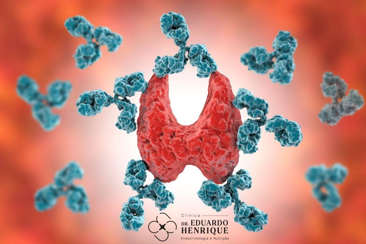 Exame de Anticorpos Antiperoxidase (Anti-TPO): descubra como ele pode ajudar no diagnóstico das doen