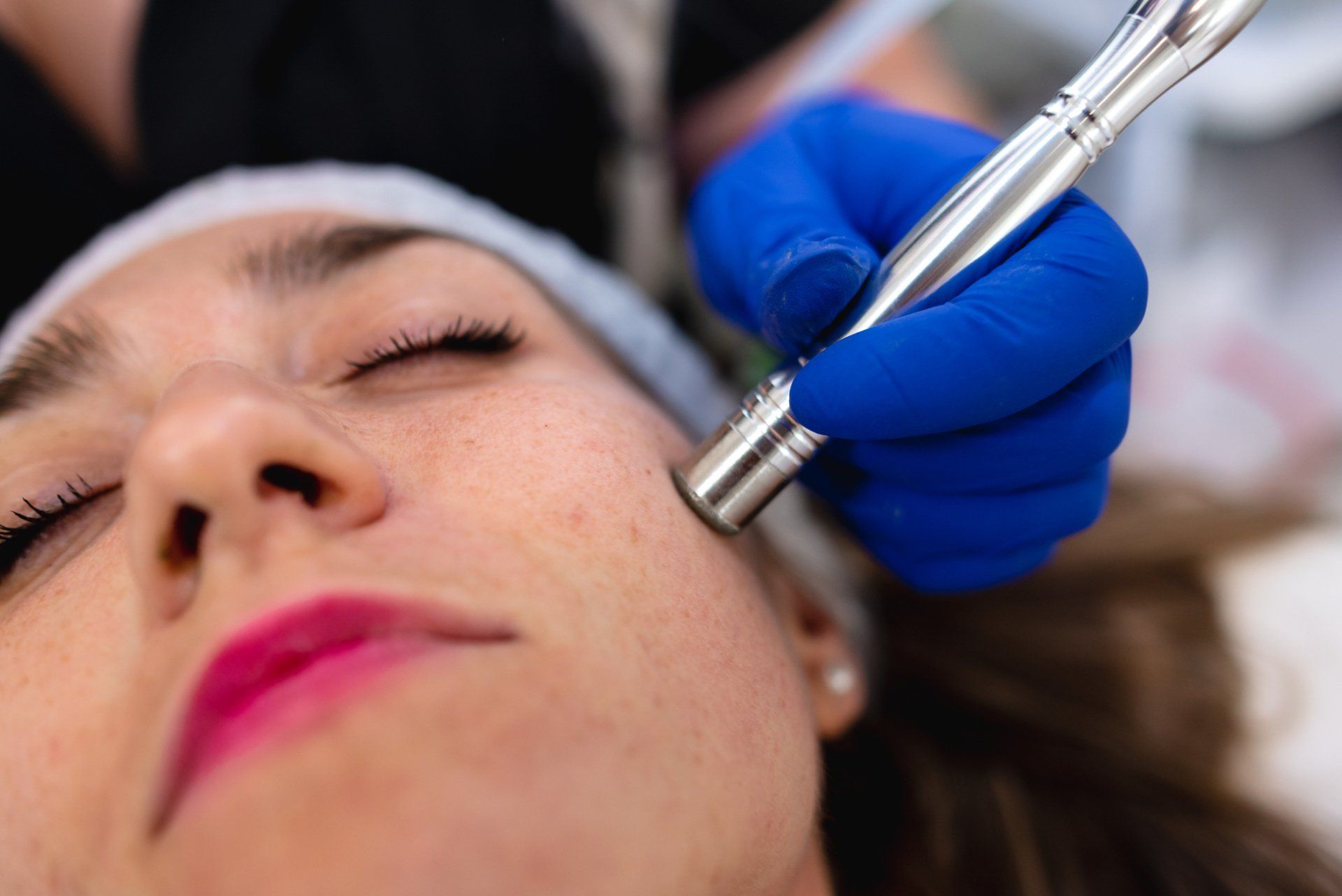 Diamond Microdermabrasion 