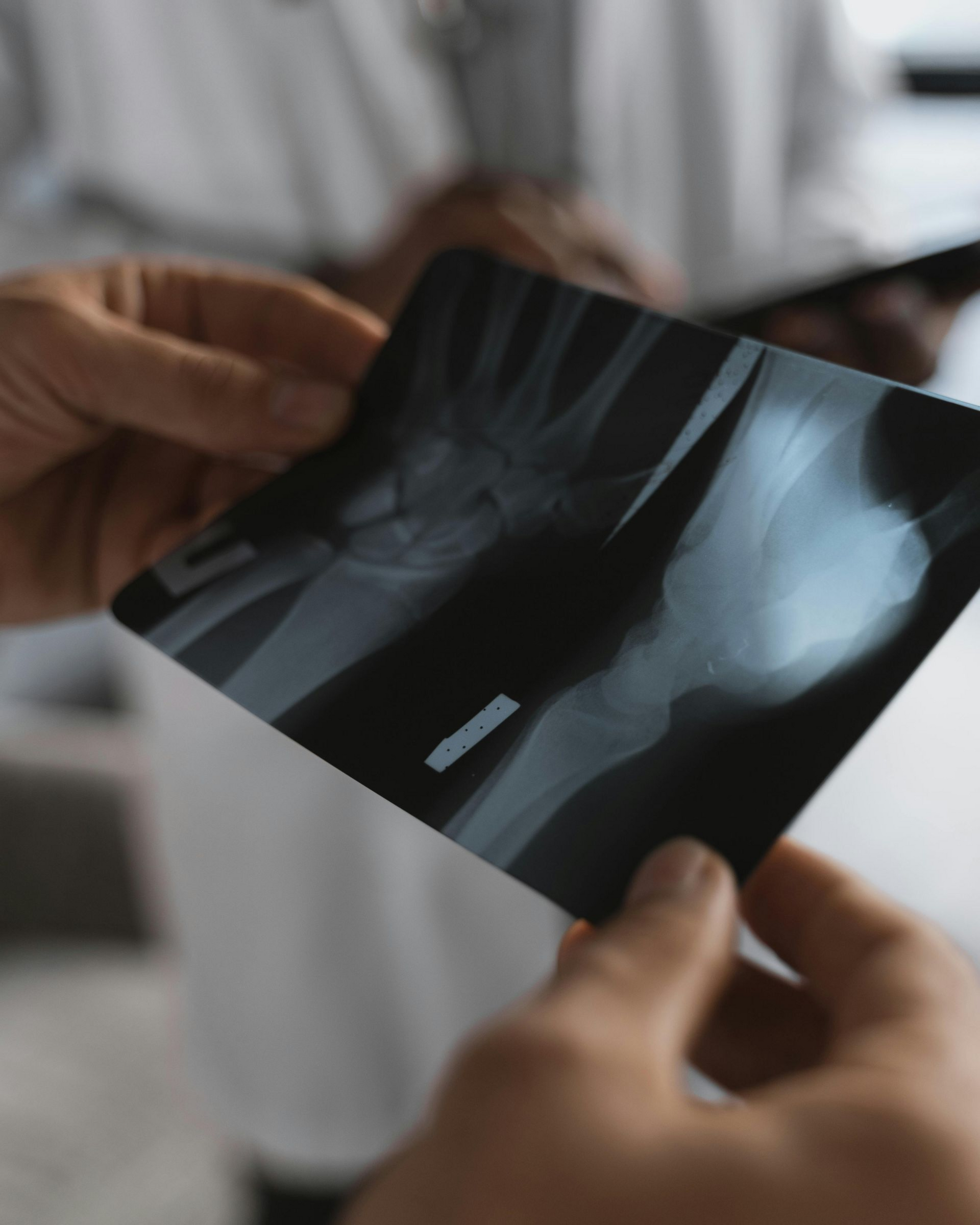 Doctor holding an X-ray of an arm, likely examining for a possible fracture, indoors.