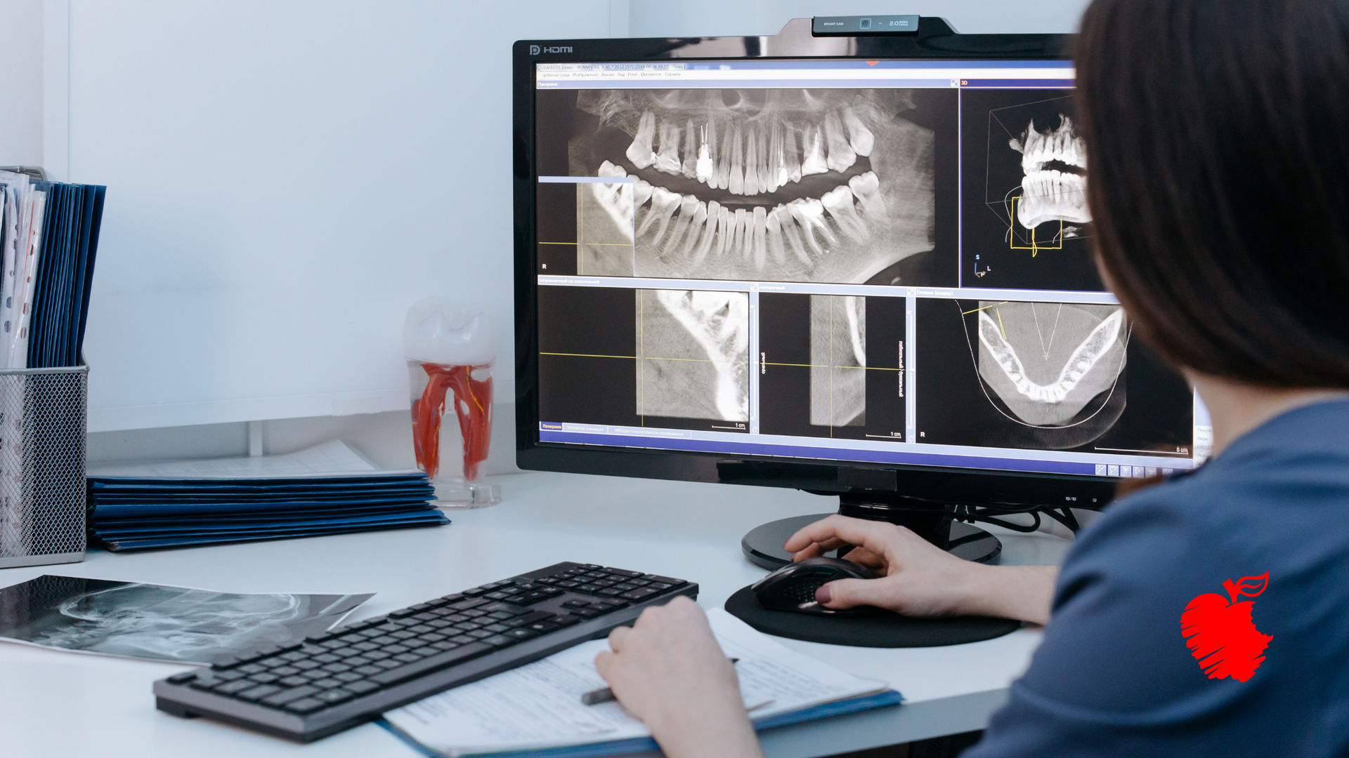 A woman is sitting at a desk looking at an x-ray on a computer screen.