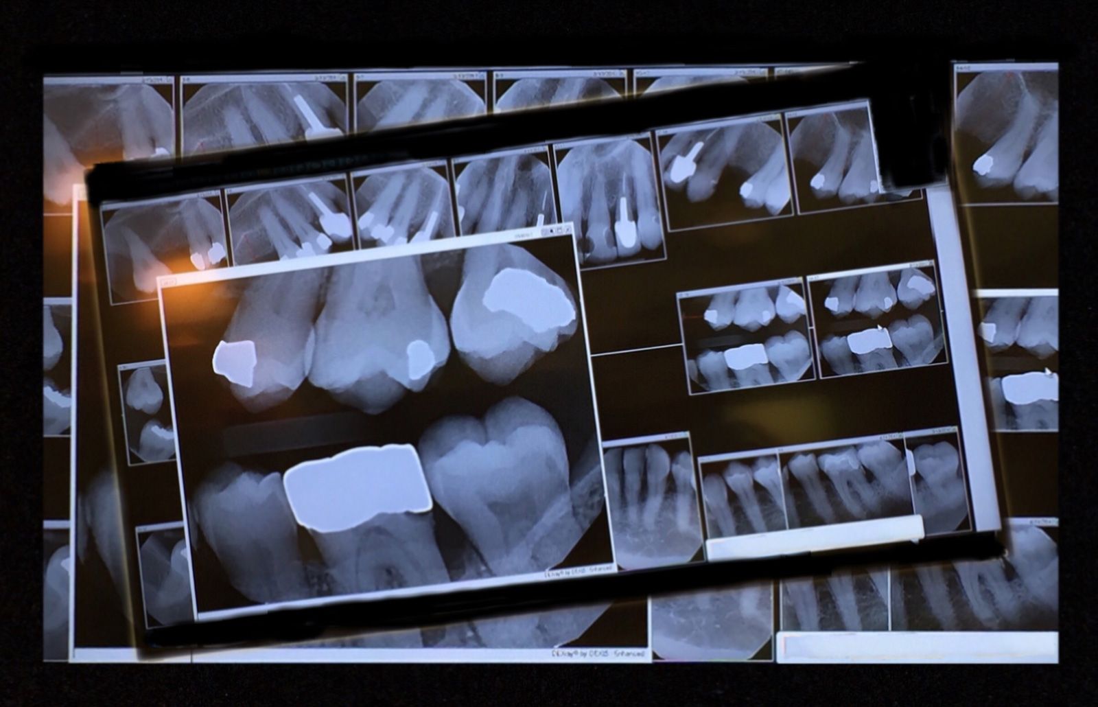 Digital X-rays — Newark, DE — Progressive Dental Arts Christiana Digital X-rays — Newark, DE — Progressive Dental Arts Christiana