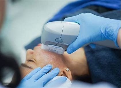 HIFU High Intensity Focused Ultrasound Face