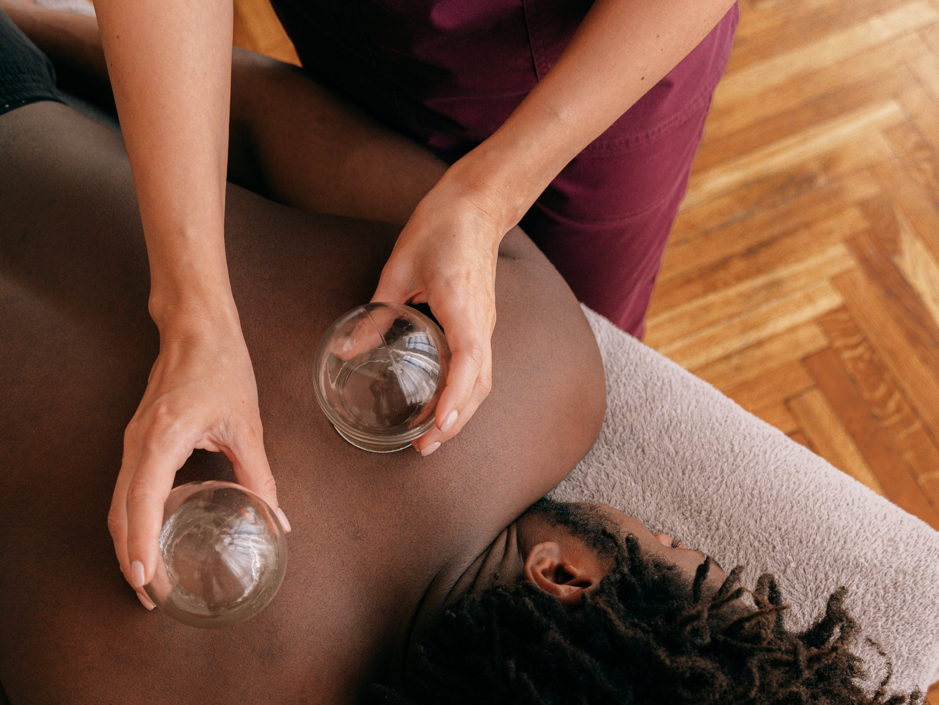 Person receiving cupping therapy on their back, therapist holding glass cups.