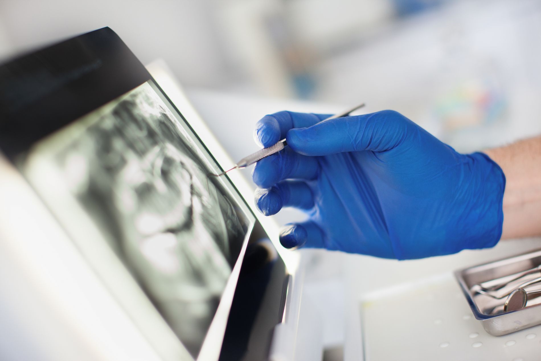 radiografia dentale