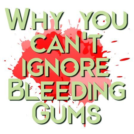 A poster that says why you can 't ignore bleeding gums