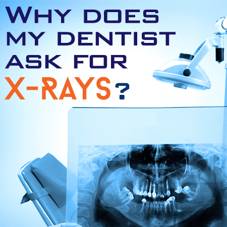 A poster that says why does my dentist ask for x-rays