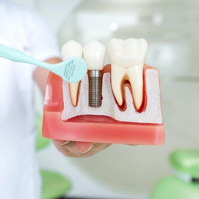 A person is brushing a model of teeth with a toothbrush.