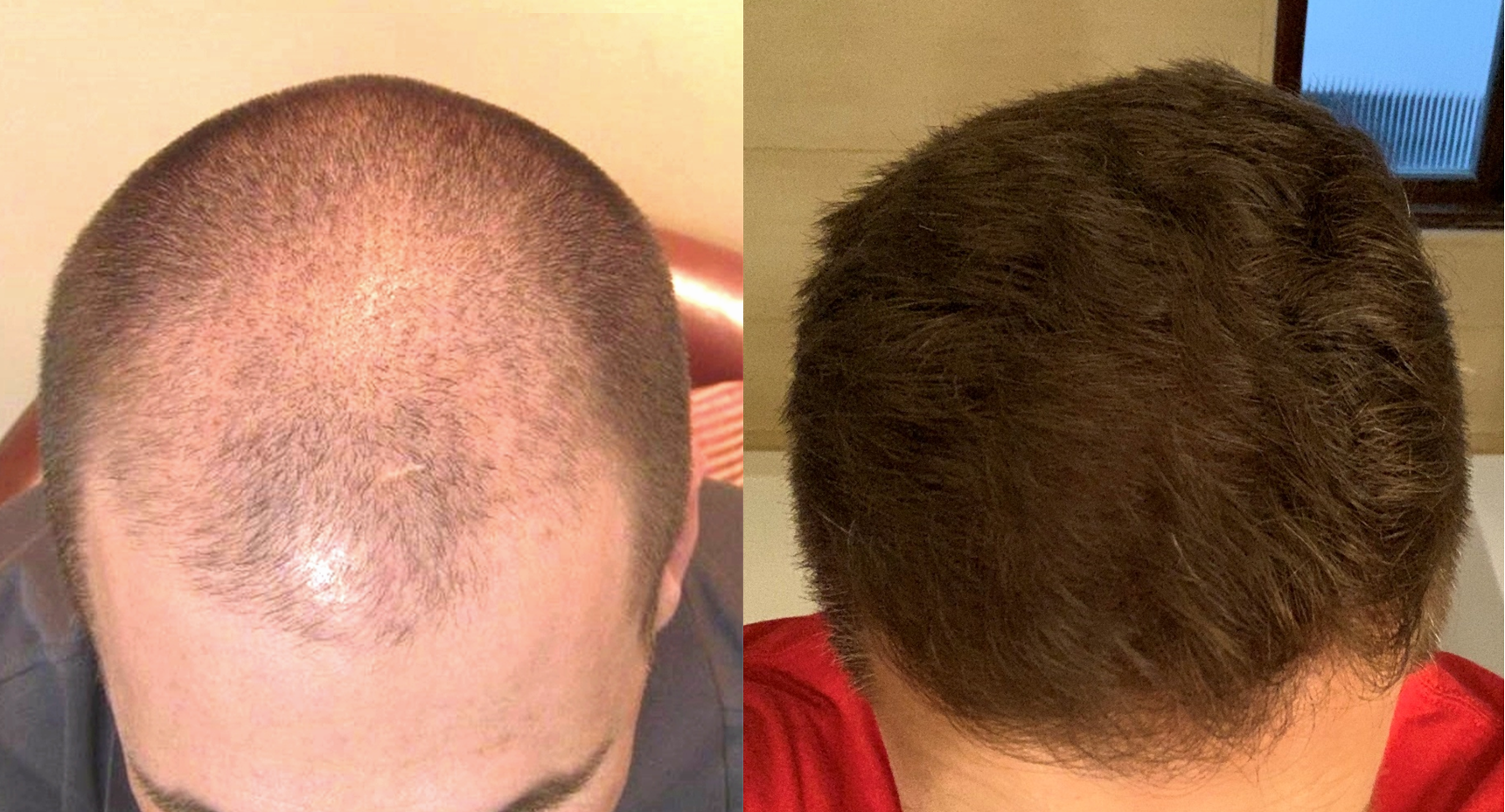 what 9 years of stop and regrow looks like