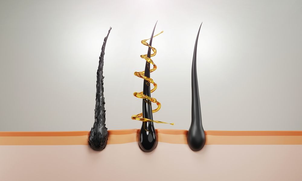 dht and hair health - how dht causes hair loss
