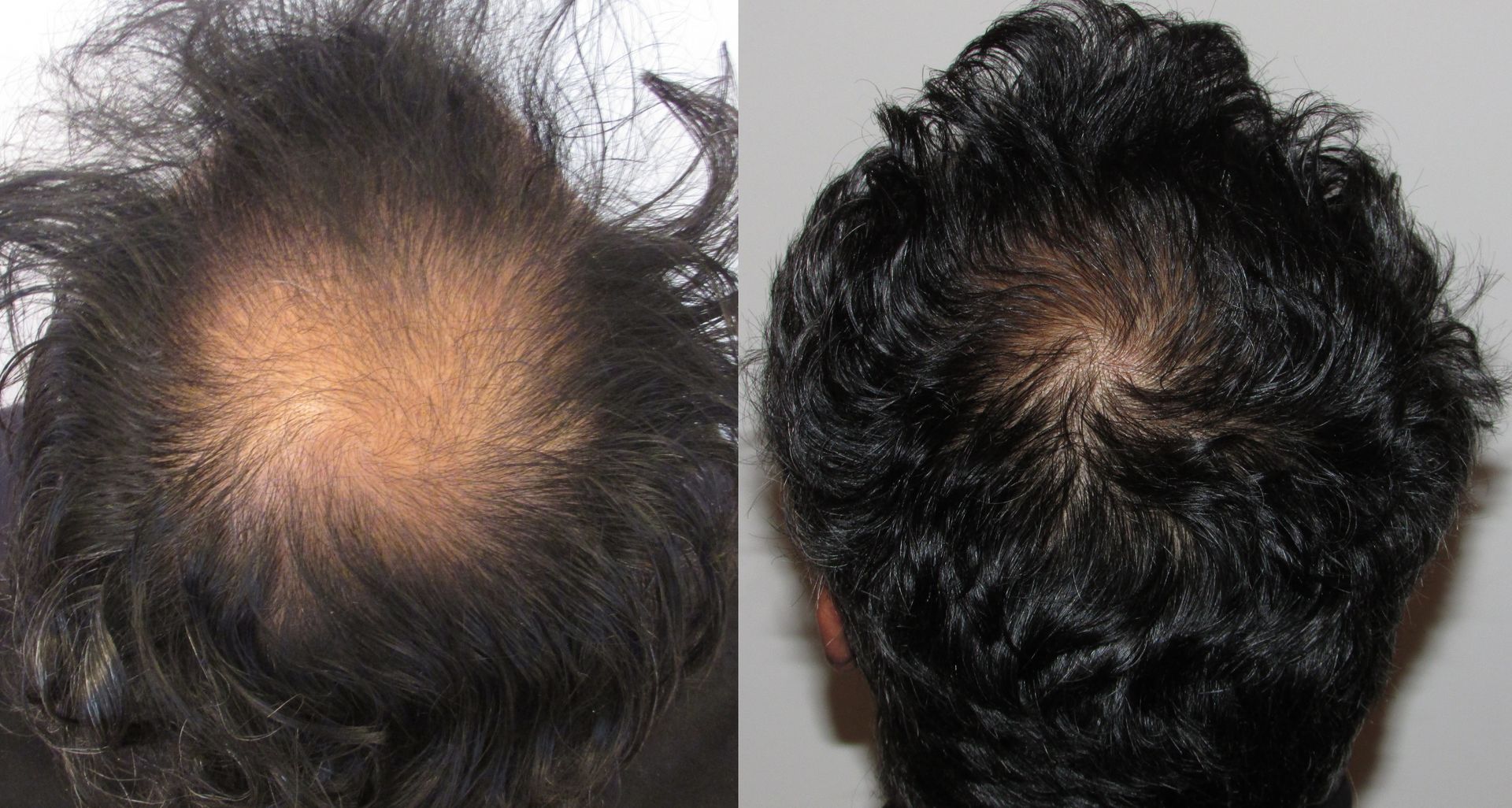 stop and regrow before and after