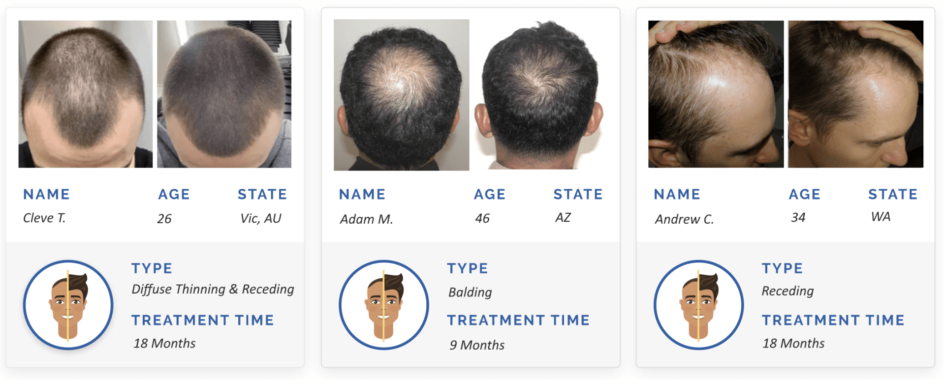 before and after hair regrowth stories