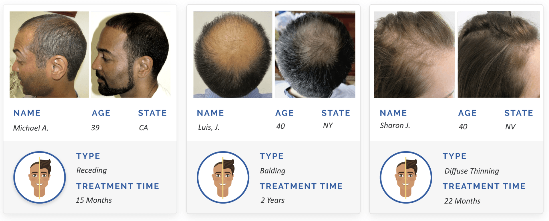 before and after hair regrowth images