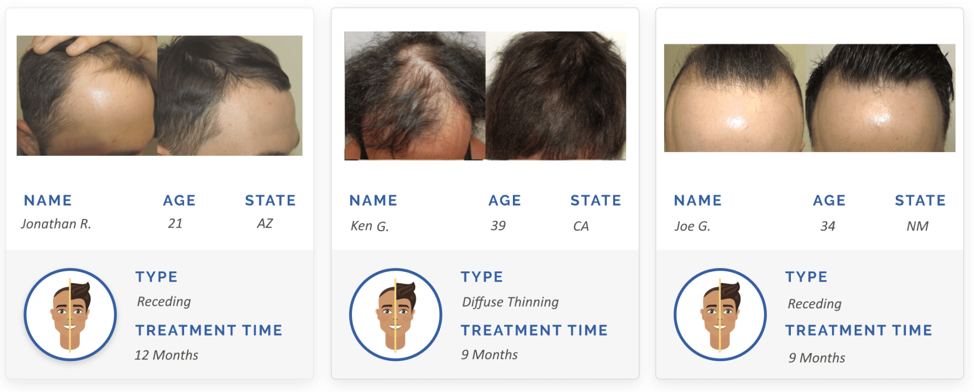 before and after hair regrowth pictures
