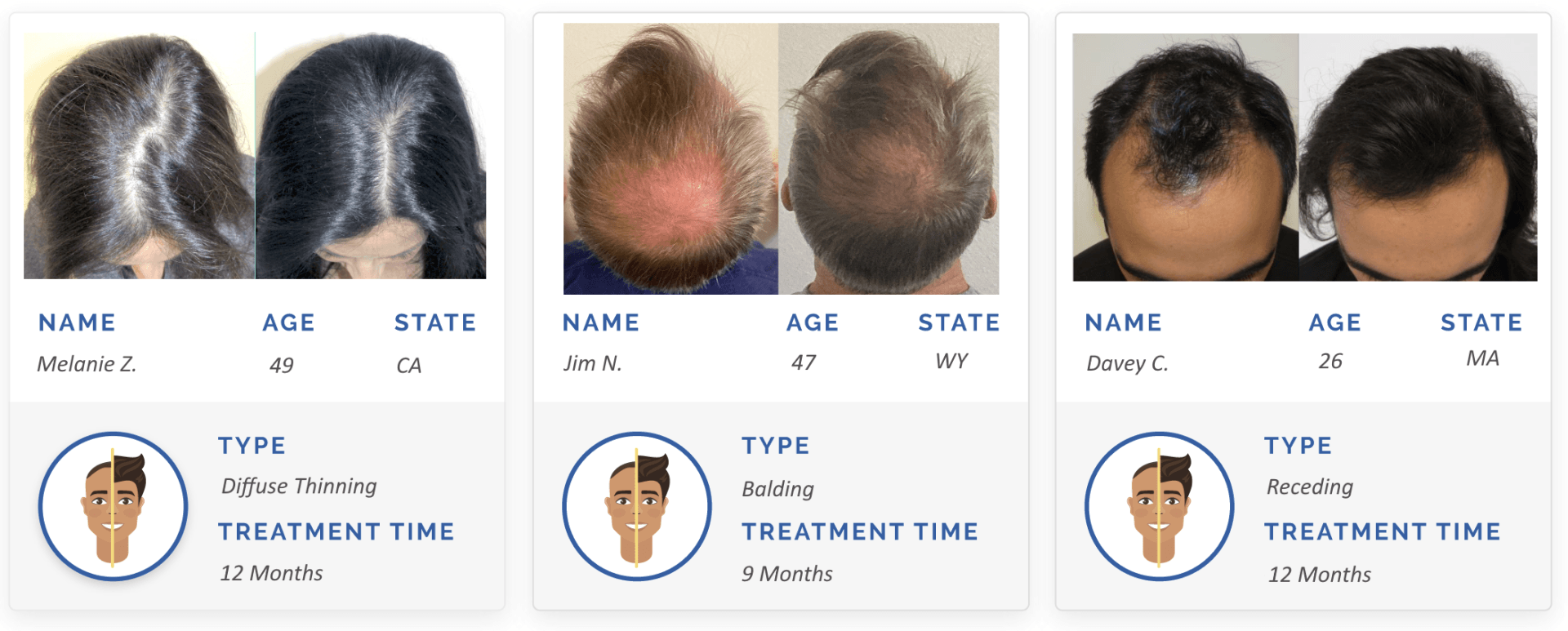 before and after hair regrowth images