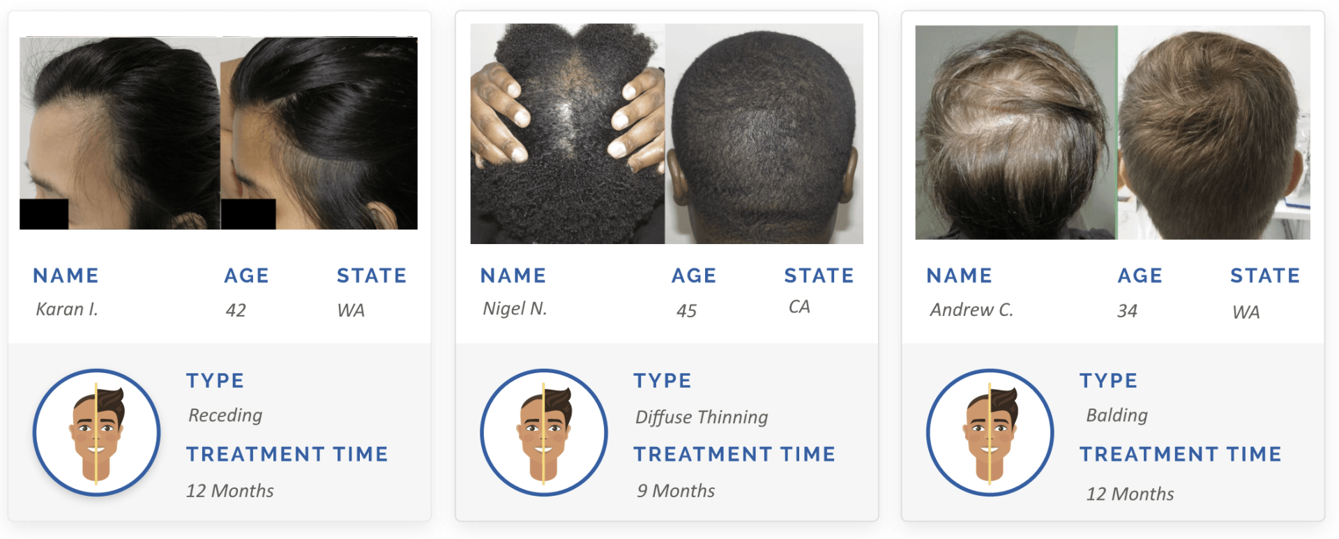 before and after hair regrowth solution