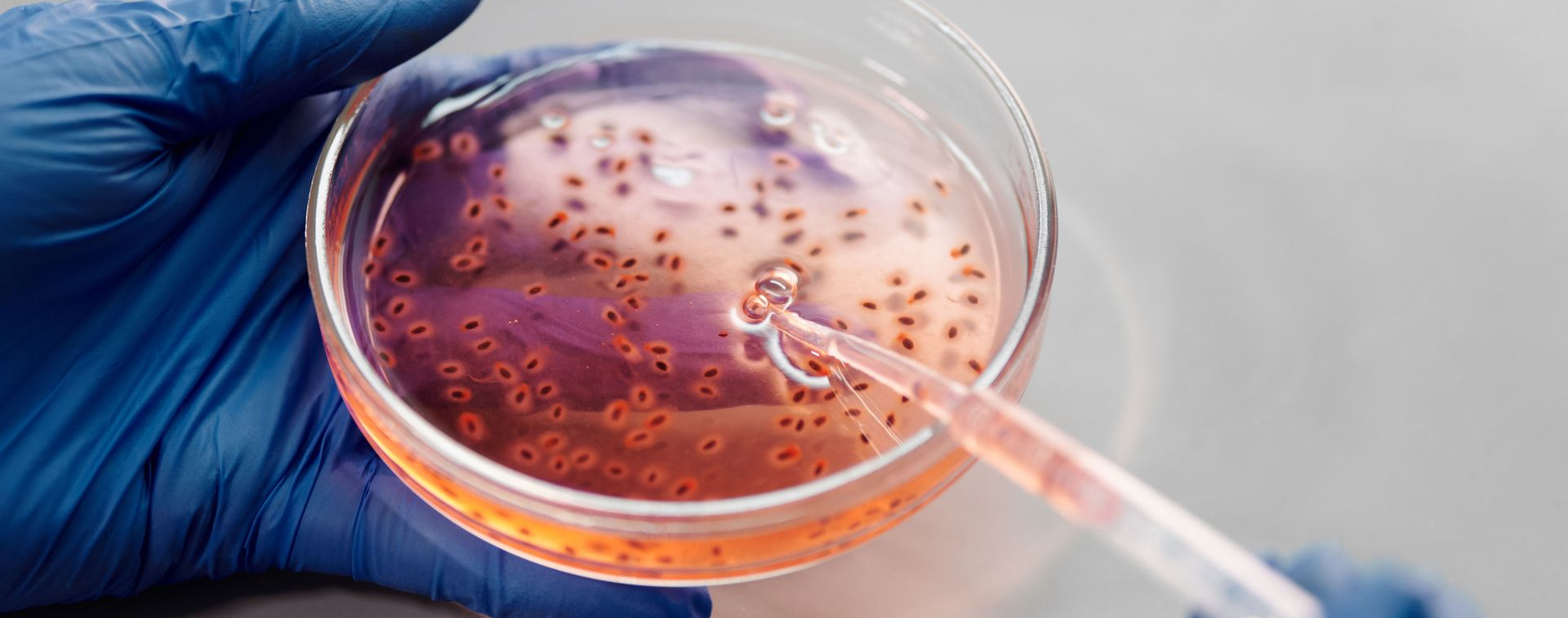 Do Exosomes Actually Regrow Hair?