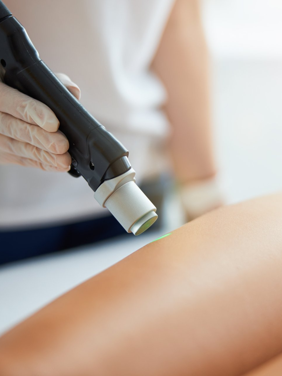 laser hair removal after 1 session