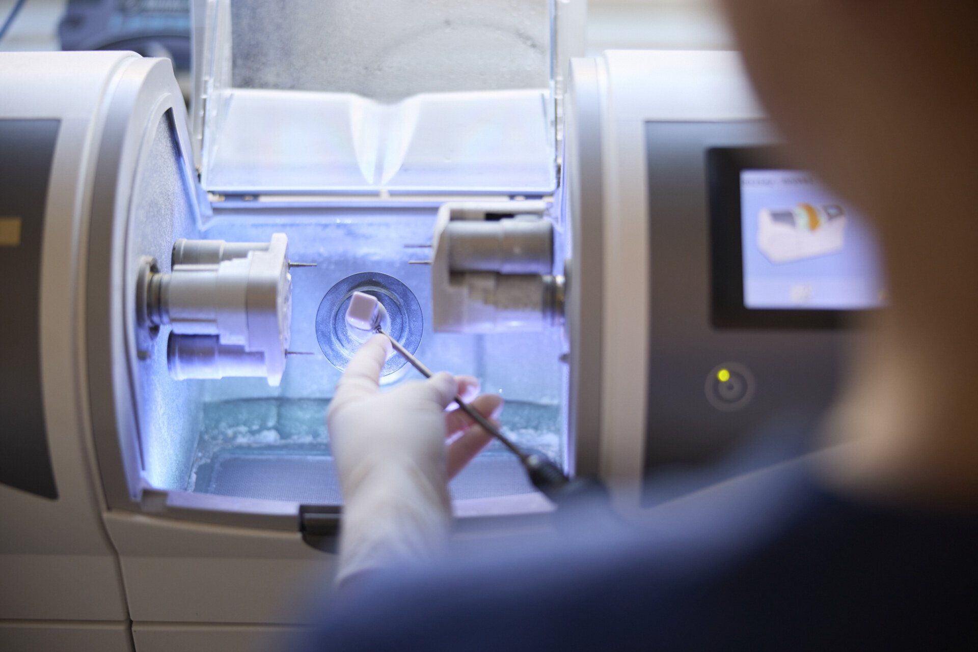 Cerec 3D technology Learn more about 3D Cerec technology!