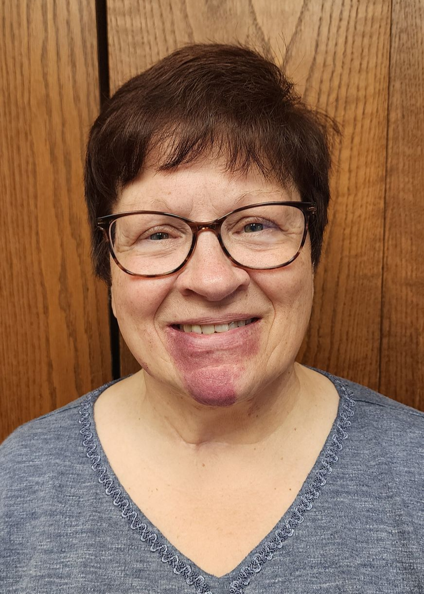 Woman with short brown hair and glasses smiles. She wears a blue shirt and has a reddish mark on her chin.