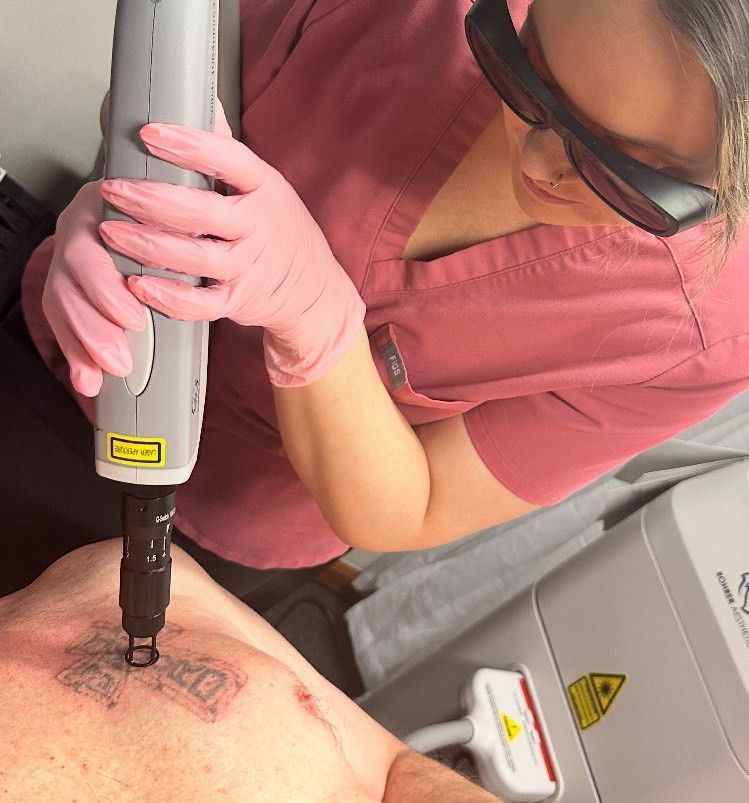 Woman in pink gloves and scrubs uses laser tattoo removal tool on a person's chest.