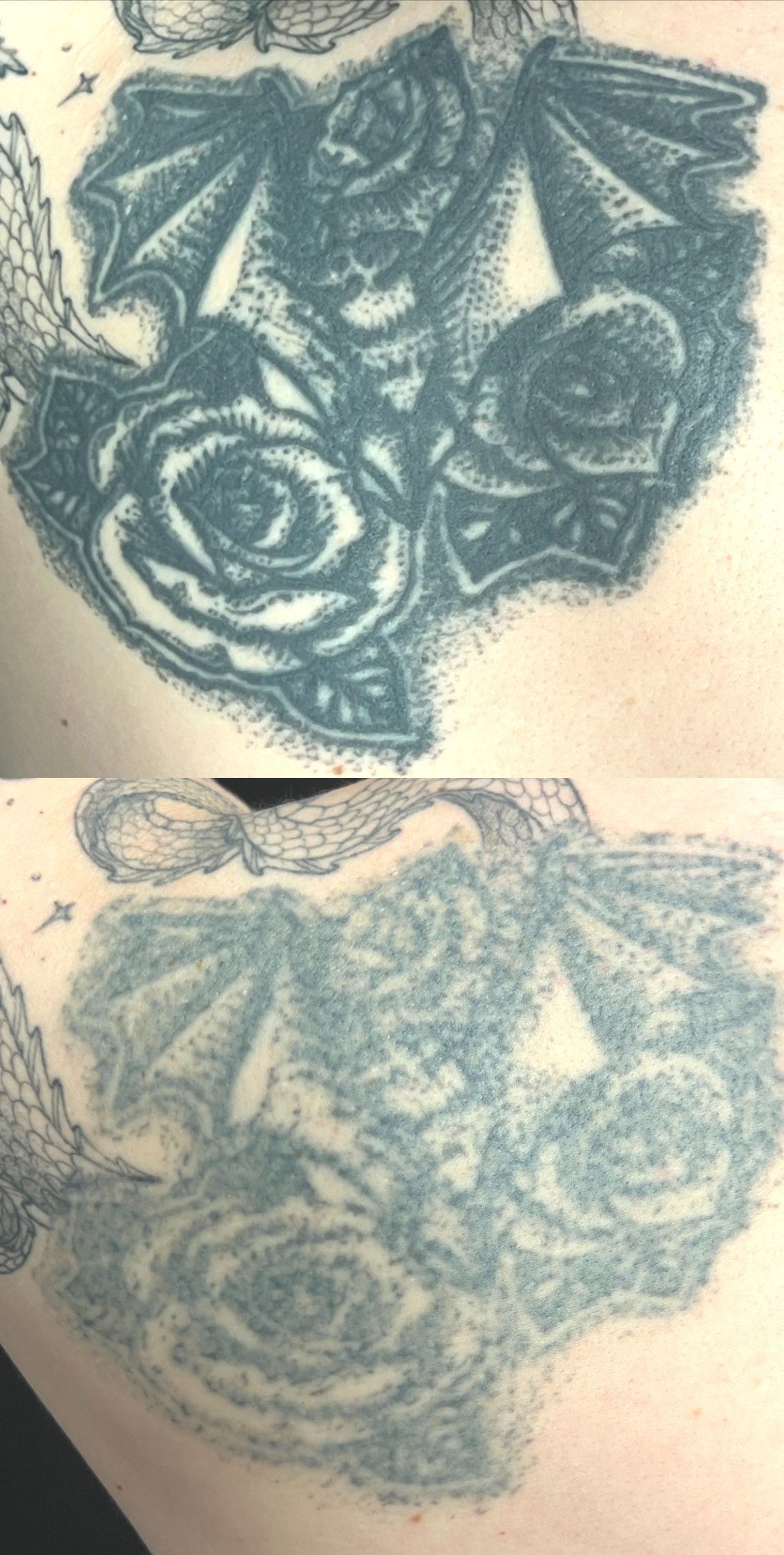 Two faded blue rose tattoos on skin.