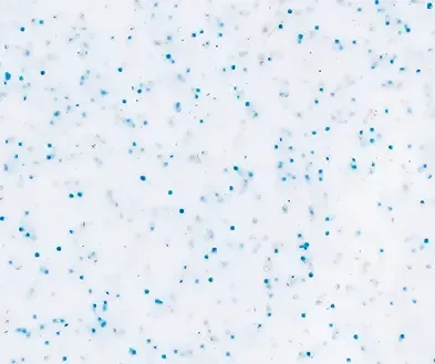 White background with scattered light blue confetti-like specks and faint pink dots